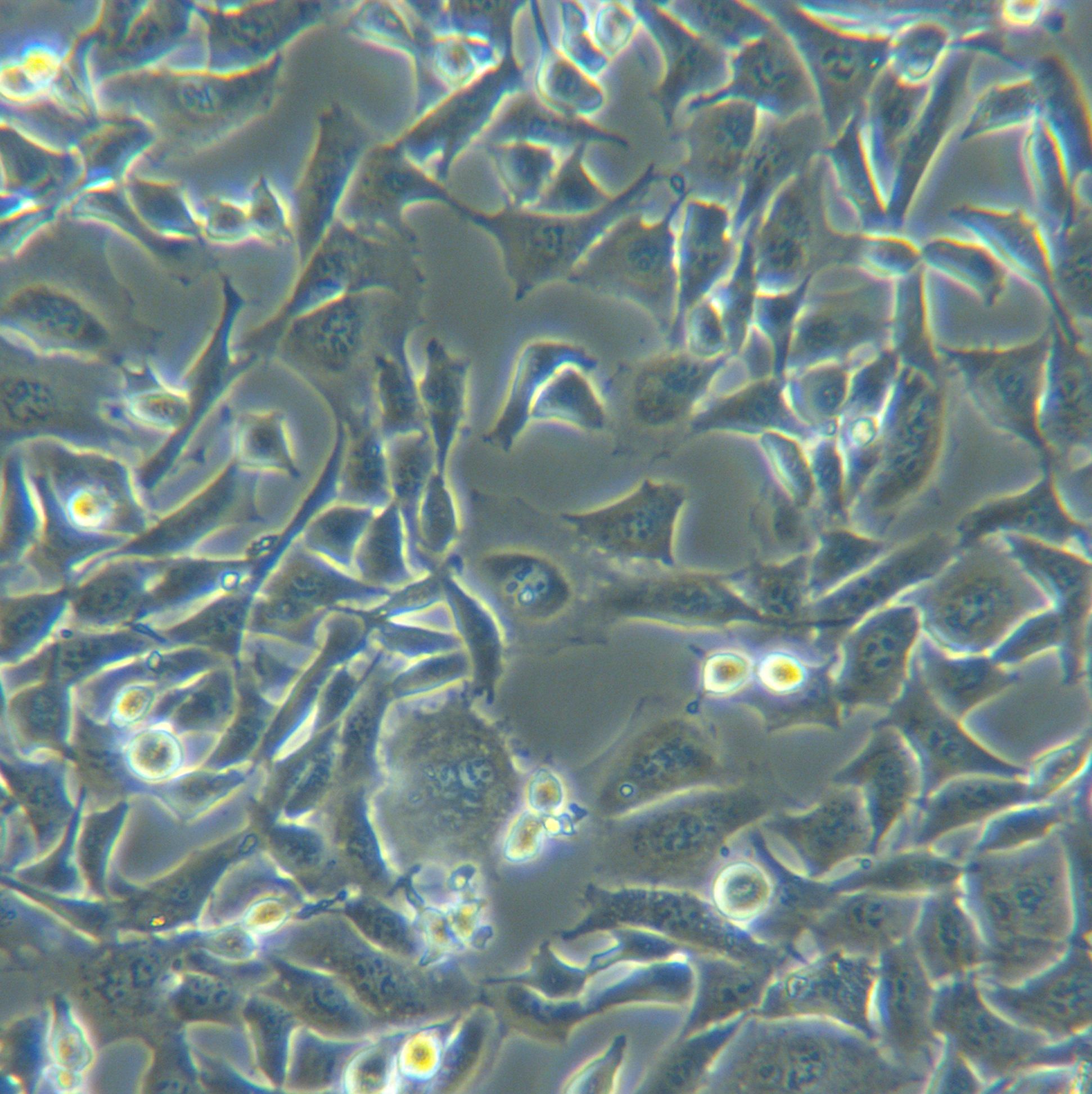 SCC-7[SCC7;SCC 7]小鼠鳞状细胞癌细胞
