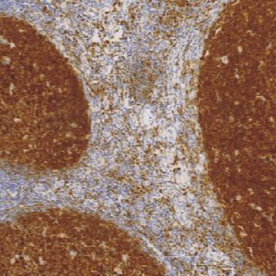 鼠抗人B 细胞特异性八聚体结合蛋白-1单克隆抗体  TDCBM-0080