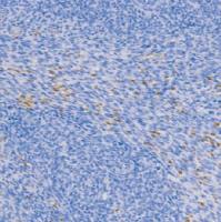 鼠抗人膜黏连蛋白A1单克隆抗体 TDCAM-0220