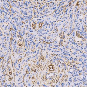 兔抗人钙结合蛋白单克隆抗体  TDCCR-0200