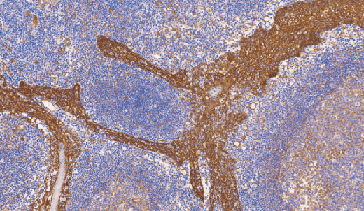 鼠抗人β-连接素单克隆抗体  TDCBM-0031