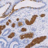 兔抗人Bax 单克隆抗体 TDCBR-0110