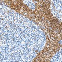 鼠抗人Bcl-3癌基因蛋白单克隆抗体 TDCBM-0042