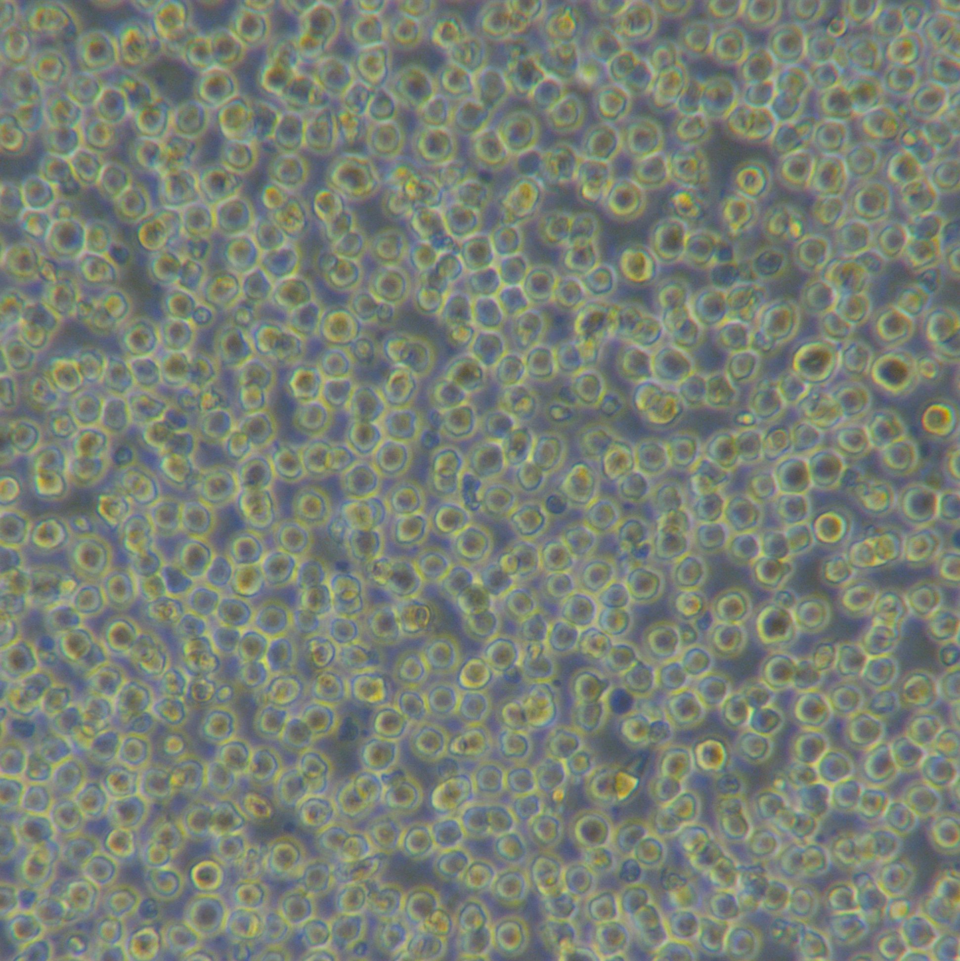 MV4-11[MV-4-11; MV-4:11; MV4:11]人急性单核细胞白血病细胞