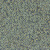 MV4-11[MV-4-11; MV-4:11; MV4:11]人急性单核细胞白血病细胞