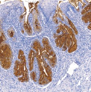 鼠抗人卵巢癌抗原单克隆抗体  TDCCM-0151