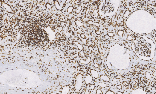 兔抗人ARID1A单克隆抗体 TDCAR-0240