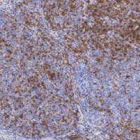 鼠抗人CD1a单克隆抗体  TDCCM-0313