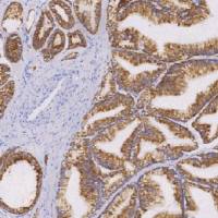 鼠抗人α-甲基酰基辅酶A消旋酶单克隆抗体 TDCAM-0201