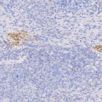 兔抗人BraCHyury单克隆抗体 TDCBR-0120