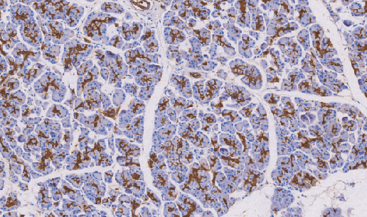 鼠抗人消化道癌抗原单克隆抗体 TDCCM-0170