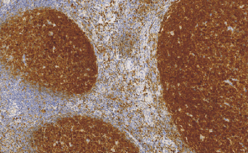 鼠抗人B 细胞特异性八聚体结合蛋白-1单克隆抗体 TDCB