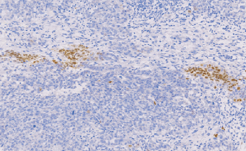 兔抗人BraCHyury单克隆抗体 TDCBR-0120