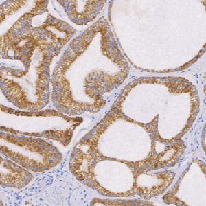 兔抗人α-甲基酰基辅酶A消旋酶单克隆抗体 TDCAR-0200