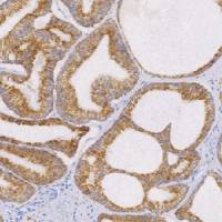 兔抗人α-甲基酰基辅酶A消旋酶单克隆抗体 TDCAR-0200