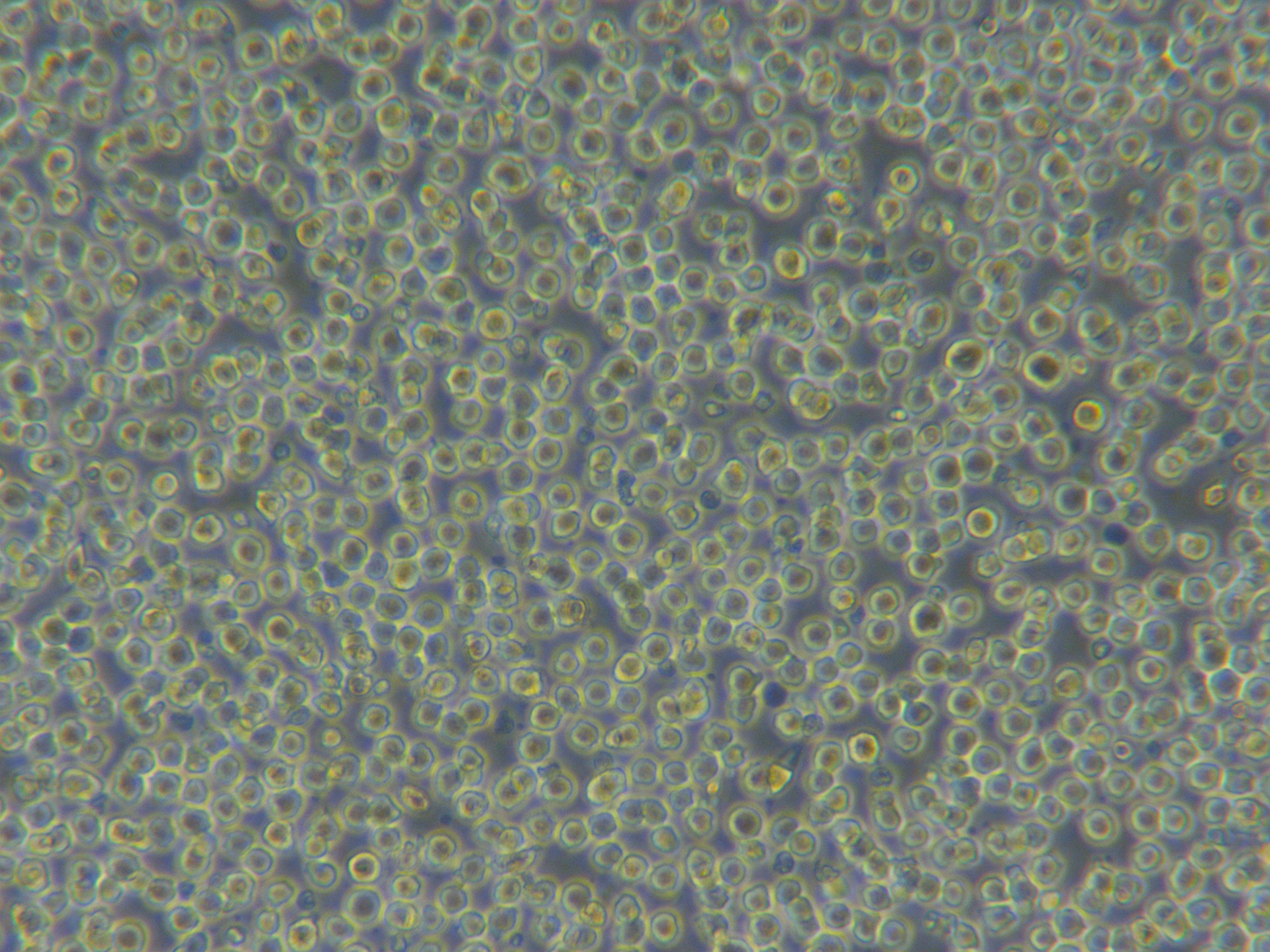 MV4-11[MV-4-11; MV-4:11; MV4:1