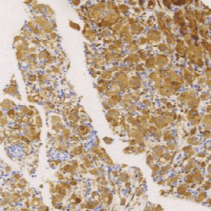 鼠抗人组织蛋白酶-K单克隆抗体 TDCCM-0290