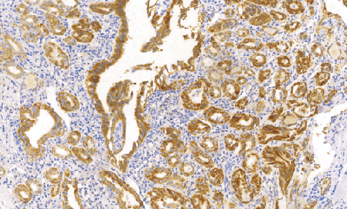 兔抗人BRAF V600E 单克隆抗体 TDCBR-0100