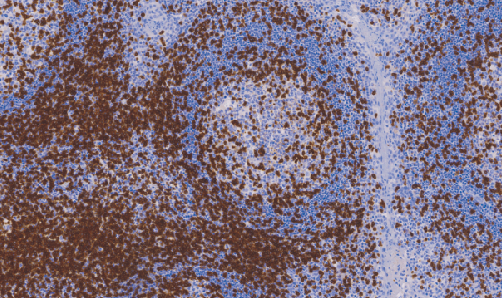 兔抗人CD3单克隆抗体 TDCCR-0331