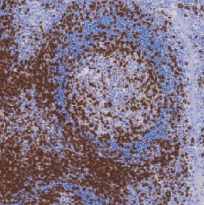 兔抗人CD3单克隆抗体 TDCCR-0331