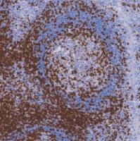 兔抗人CD3单克隆抗体 TDCCR-0331