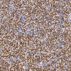 鼠抗人ATRX 单克隆抗体  TDCAM-0250