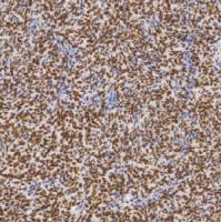 鼠抗人ATRX 单克隆抗体  TDCAM-0250