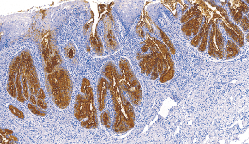 鼠抗人卵巢癌抗原单克隆抗体 TDCCM-0151