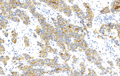 鼠抗人BCA-225单克隆抗体 TDCBM-0020