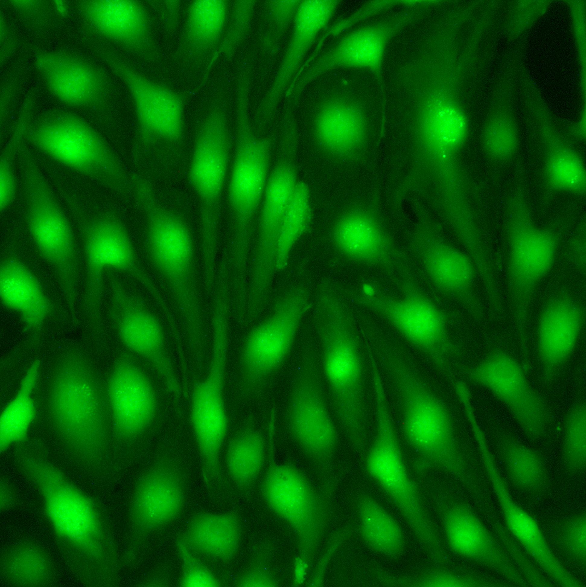 HUVEC-GFP[HUVEC/GFP]绿色荧光蛋白标记的人脐静脉内皮细胞