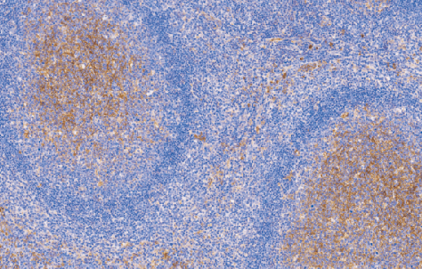 兔抗人CD14单克隆抗体  TDCCR-0420