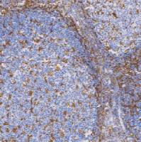 鼠抗人CD11c单克隆抗体 TDCCM-0400