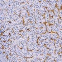 鼠抗人CD31单克隆抗体  TDCCM-0530