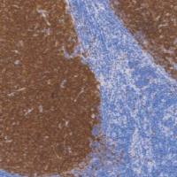 鼠抗人CD10单克隆抗体 TDCCM-0391