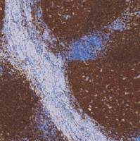 鼠抗人CD20单克隆抗体 TDCCM-0460