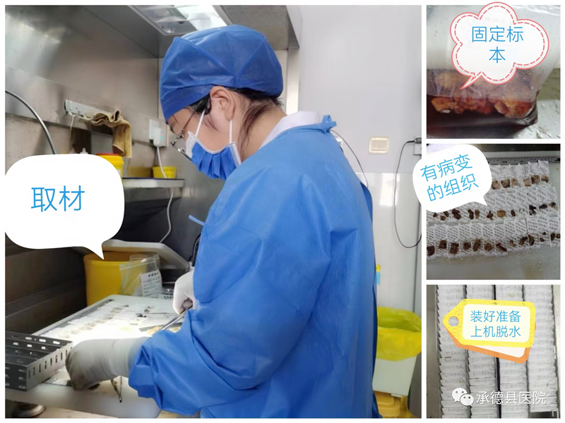 探秘病理科：病理报告为什么这么慢？