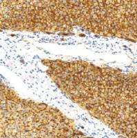 兔抗人CD13单克隆抗体 TDCCR-0411