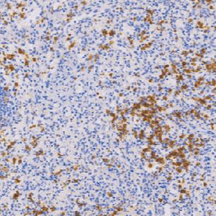 兔抗人CD11b单克隆抗体  TDCCR-1170