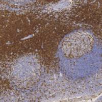 鼠抗人CD7单克隆抗体 TDCCM-0362