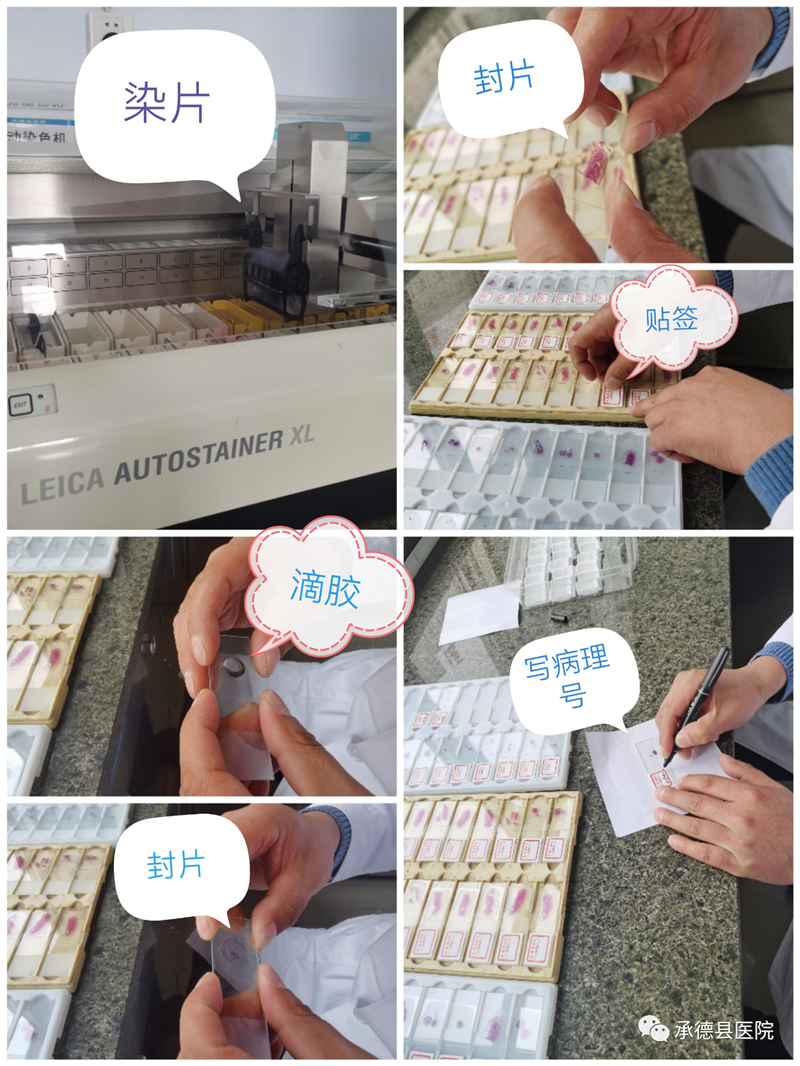 探秘病理科：病理报告为什么这么慢？