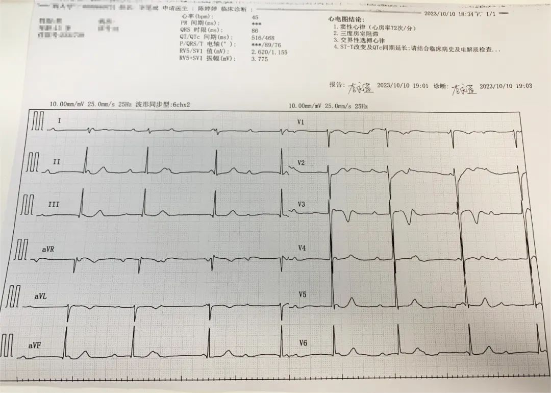重庆松山医院完成首例无导线双腔起搏器植入