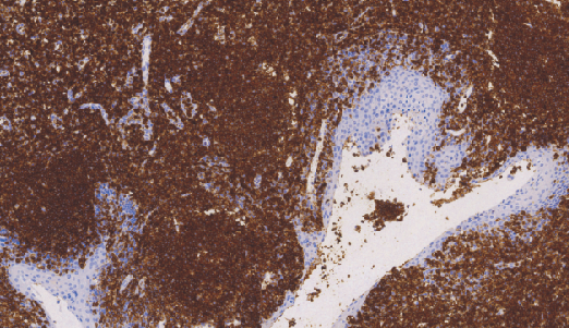 鼠抗人白细胞共同抗原(CD45)单克隆抗体 TDCCM-0