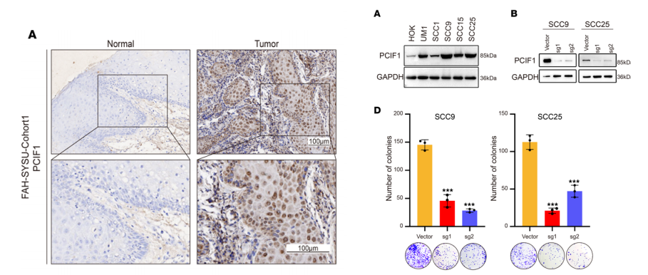 分子探针与表观遗传学研究好文分享：CTBP2-PCIF1复合物调控头颈部鳞状细胞癌中mRNA的m6 Am修饰（IF=15.9004）