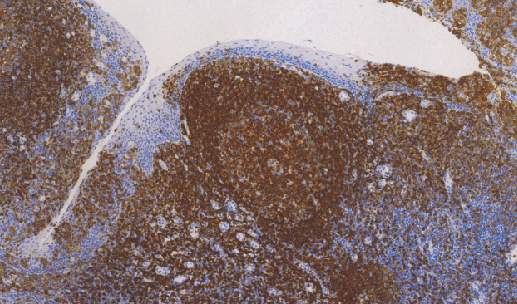 鼠抗人克隆抗体CD45R单克隆抗体 TDCCM-0630