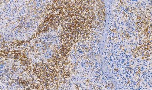 鼠抗人CD44变异体6单克隆抗体 TDCCM-0610