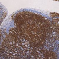 鼠抗人克隆抗体CD45R单克隆抗体  TDCCM-0630