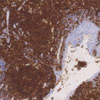 鼠抗人白细胞共同抗原（CD45）单克隆抗体  TDCCM-0621