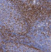 鼠抗人CD45RO(B细胞)单克隆抗体 TDCCM-0650