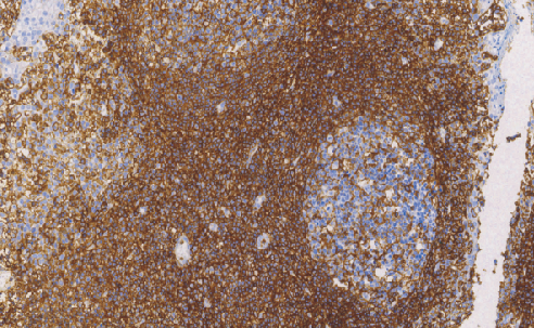 鼠抗人CD44单克隆抗体 TDCCM-0601