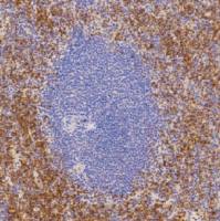 兔抗人CD42b单克隆抗体  TDCCR-0580